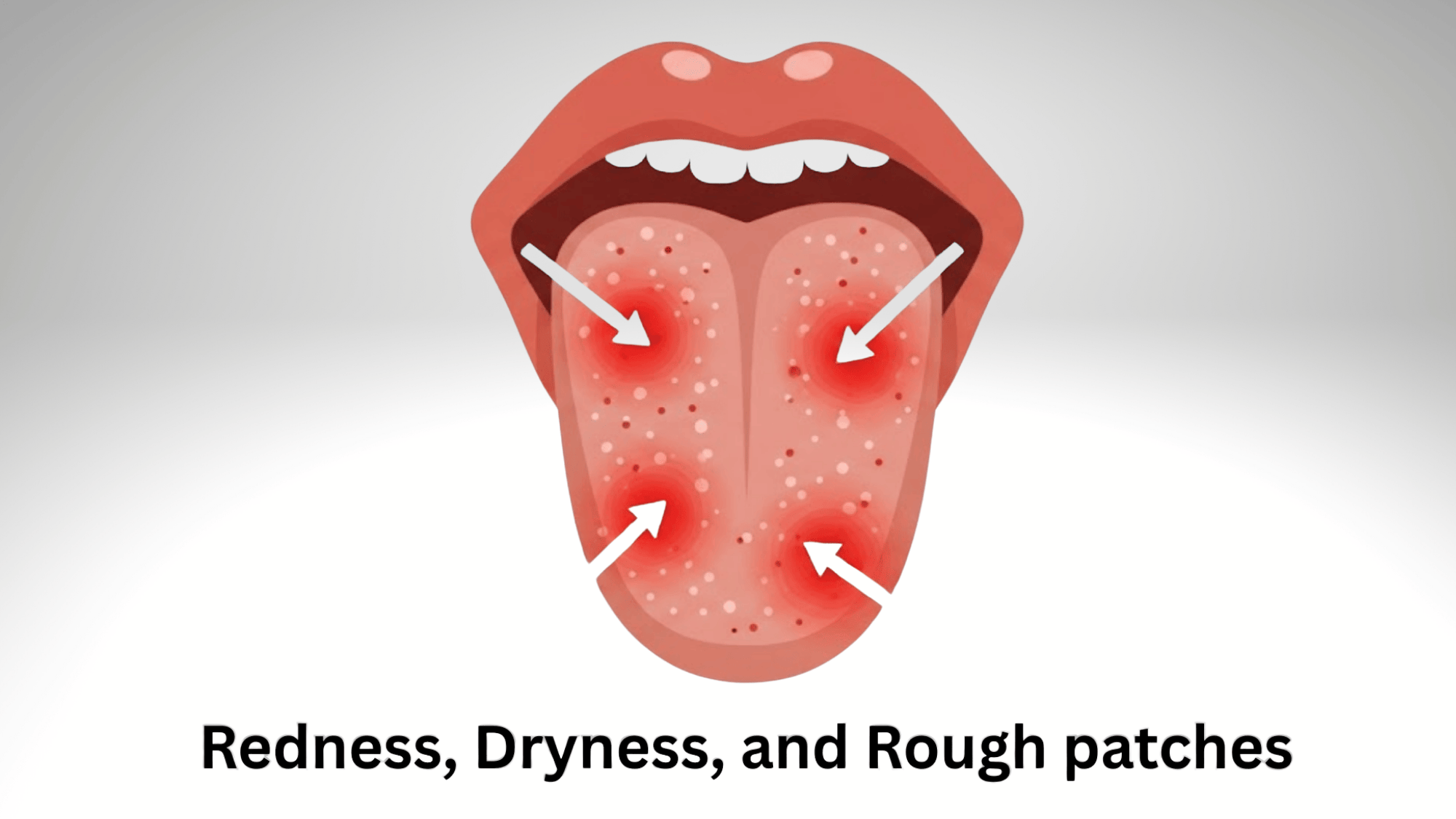 Other-symptoms