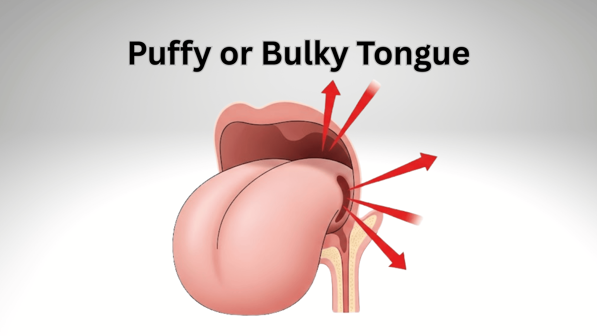 Puffy-toungue