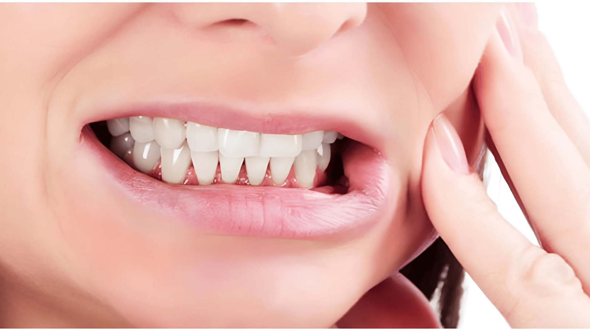 bruxism
