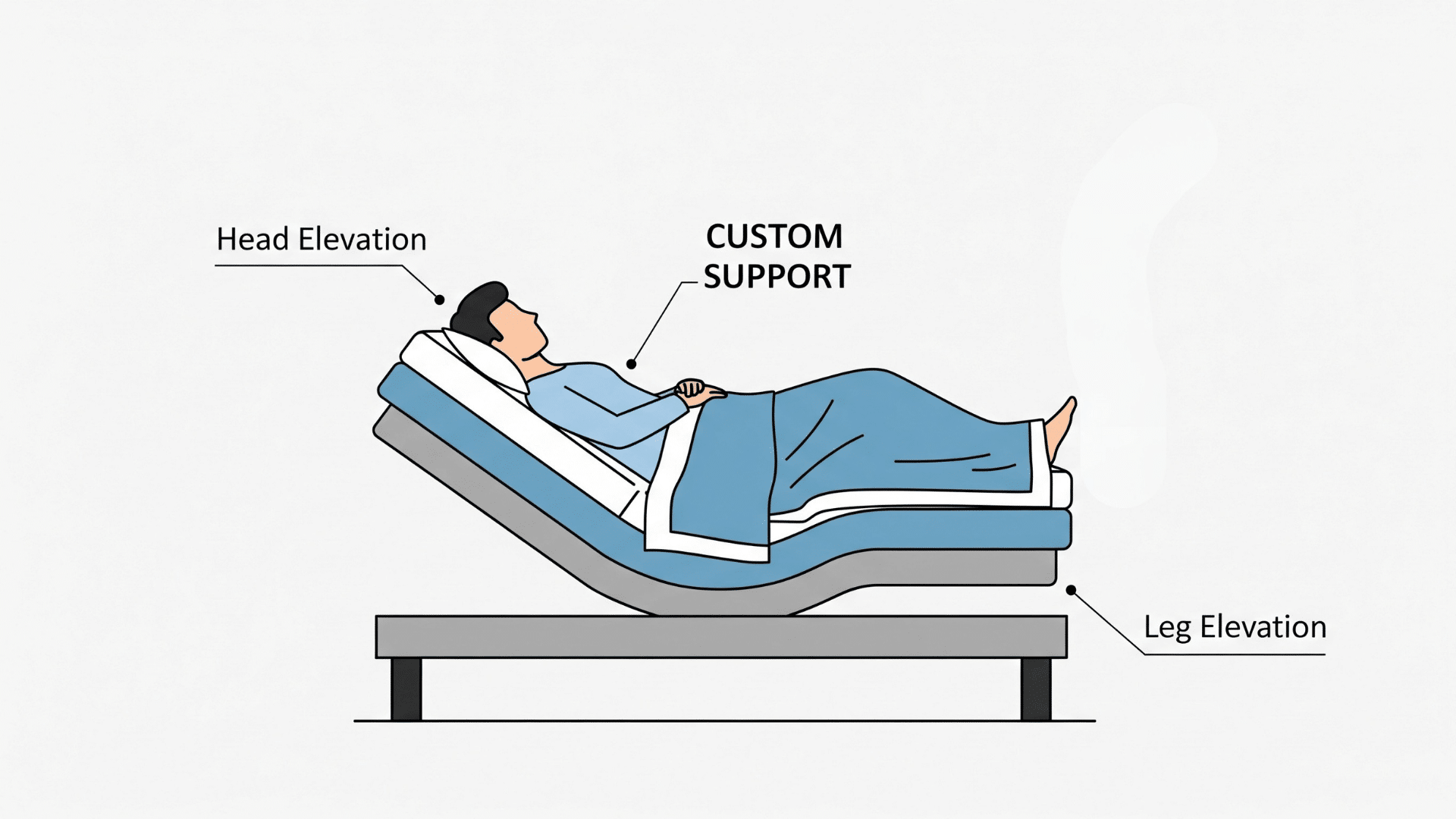 custom-support