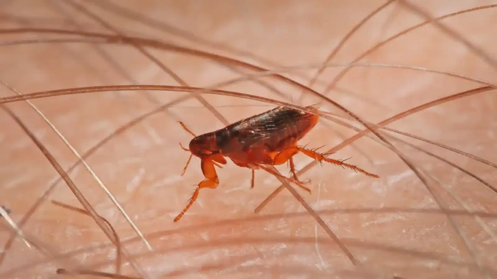 A close-up of a chigoe flea resting on skin, with visible details of its body and legs_