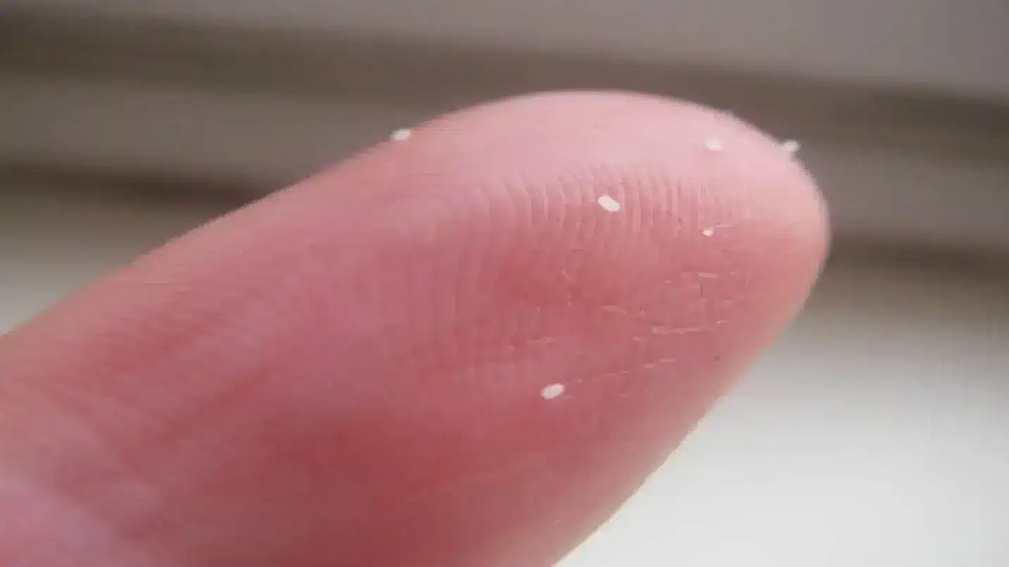 Close-up of flea eggs on a finger, illustrating the small, oval eggs that require specific conditions to hatch. (1)