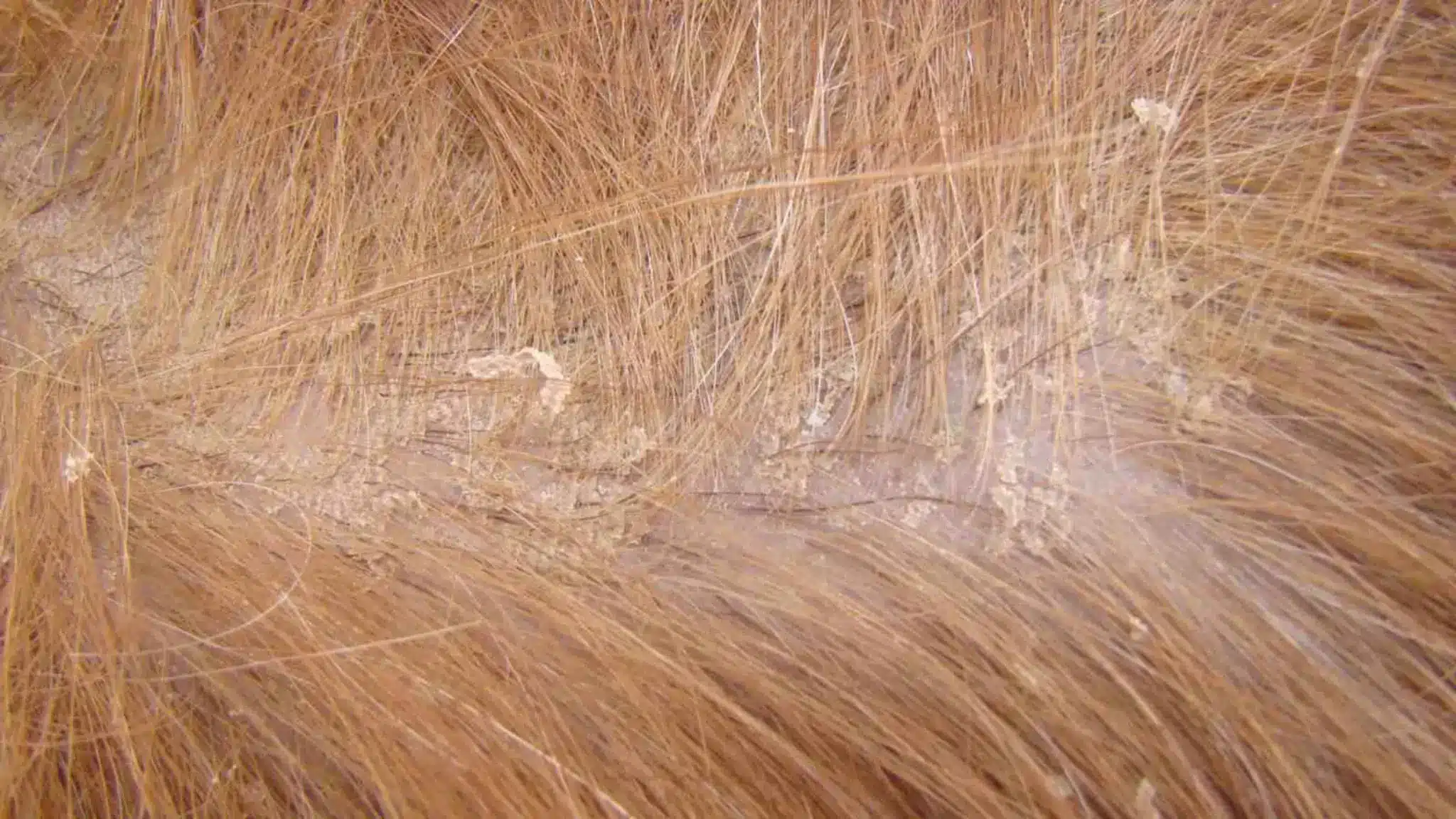 Close-up of flea eggs on a pet's fur, highlighting common places where flea eggs hatch