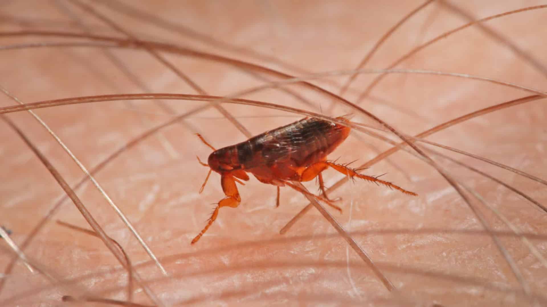 Close-up of a reddish flea moving through body hair on human skin in macro view