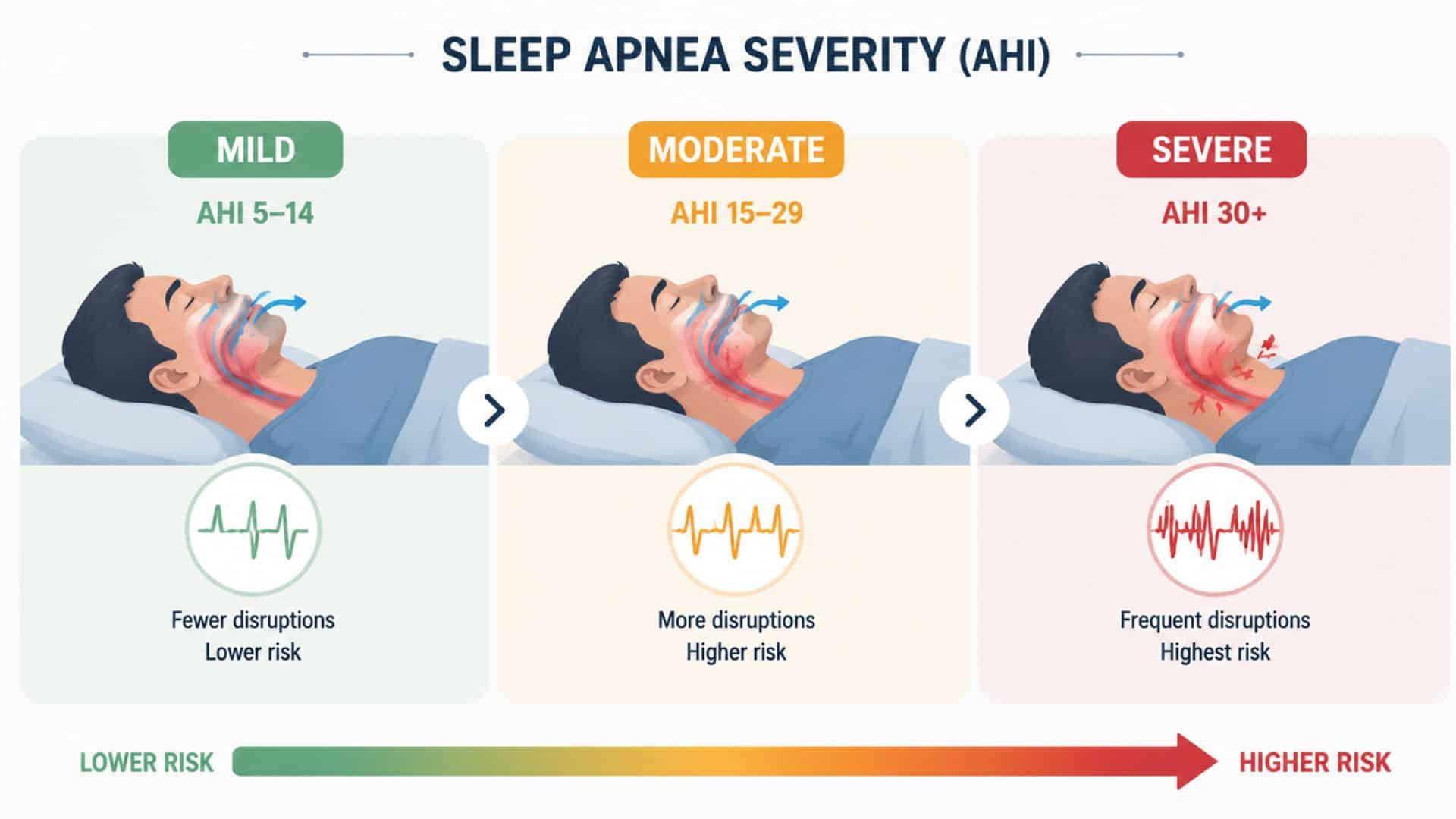 Infographic depicting the severity levels of sleep apnea, highlighting the risk and frequency of breathing disruptions