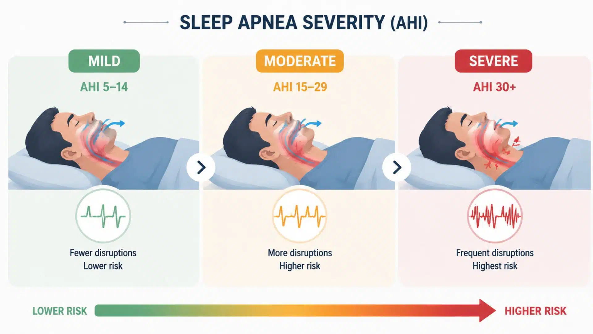 Infographic depicting the severity levels of sleep apnea, highlighting the risk and frequency of breathing disruptions