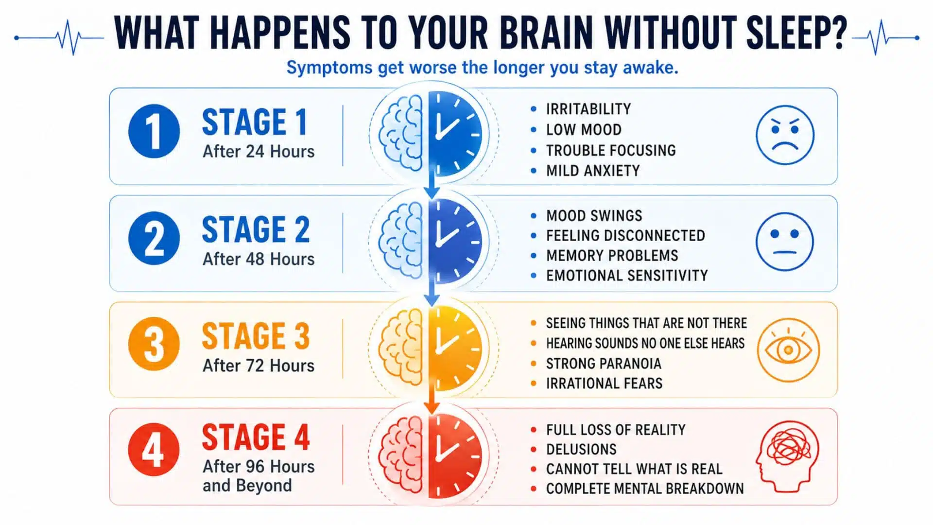 Infographic showing four stages of sleep deprivation effects on the brain with symptoms worsening over time.
