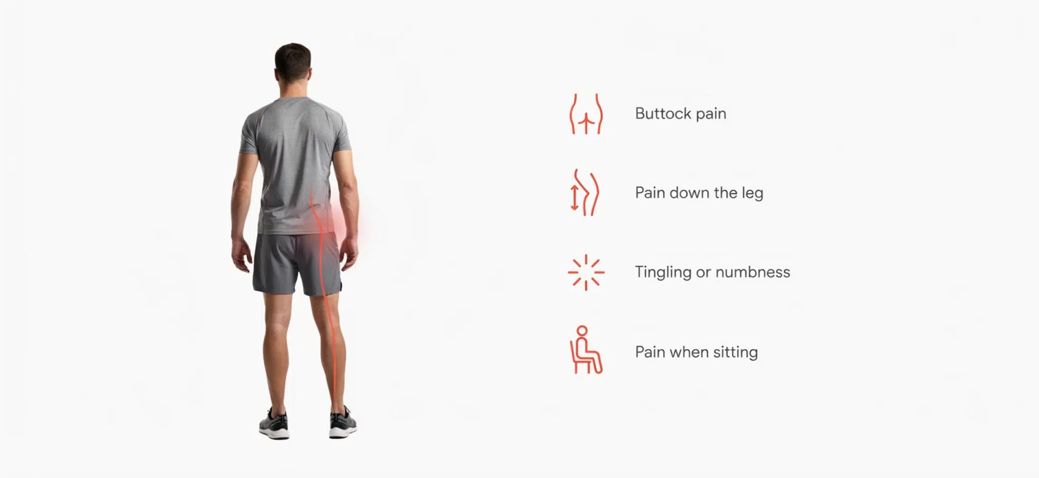 Piriformis pain symptoms