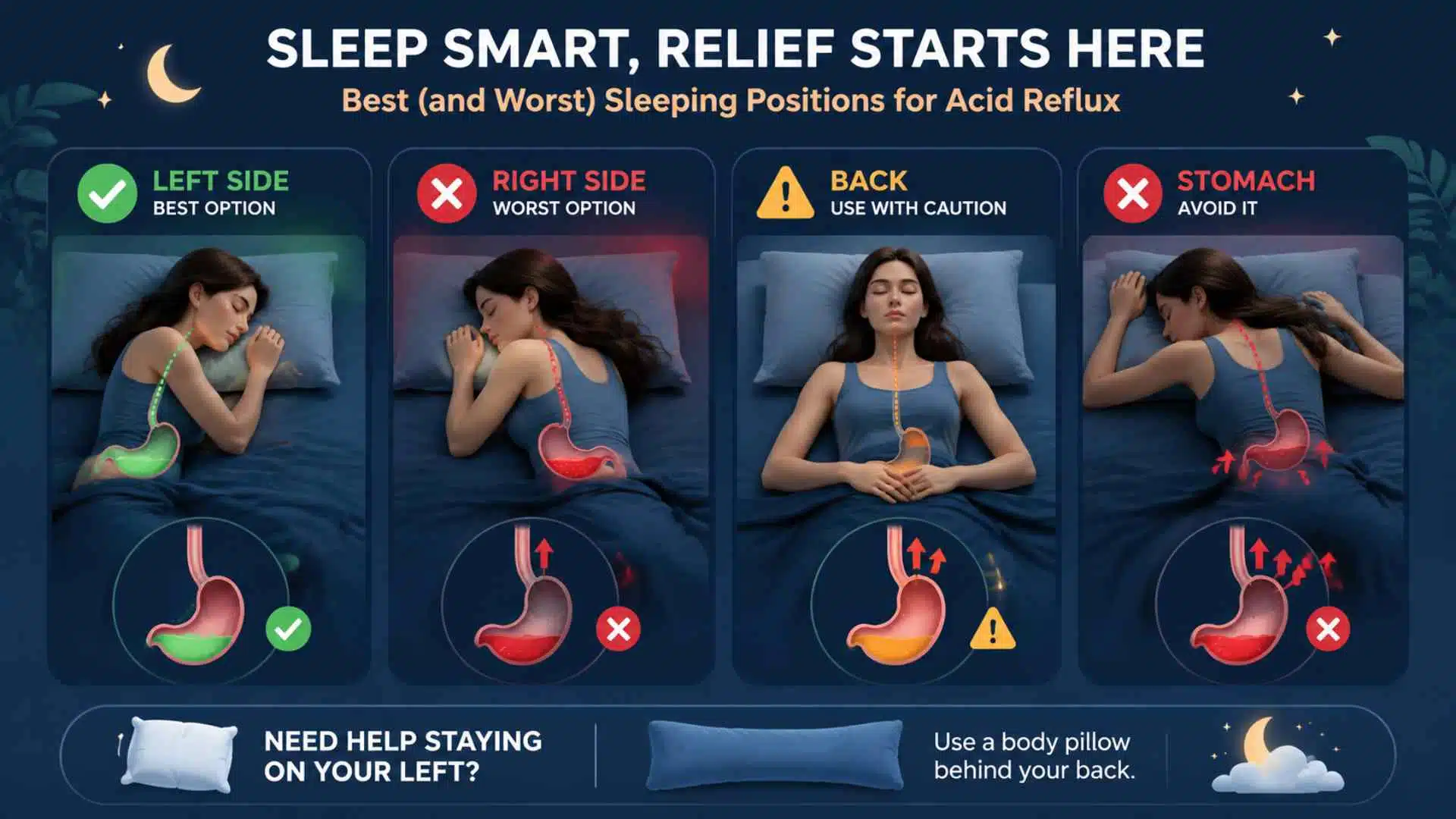 Infographic comparing acid reflux sleeping positions: left side best, right side and stomach worse, back needs a raised bed