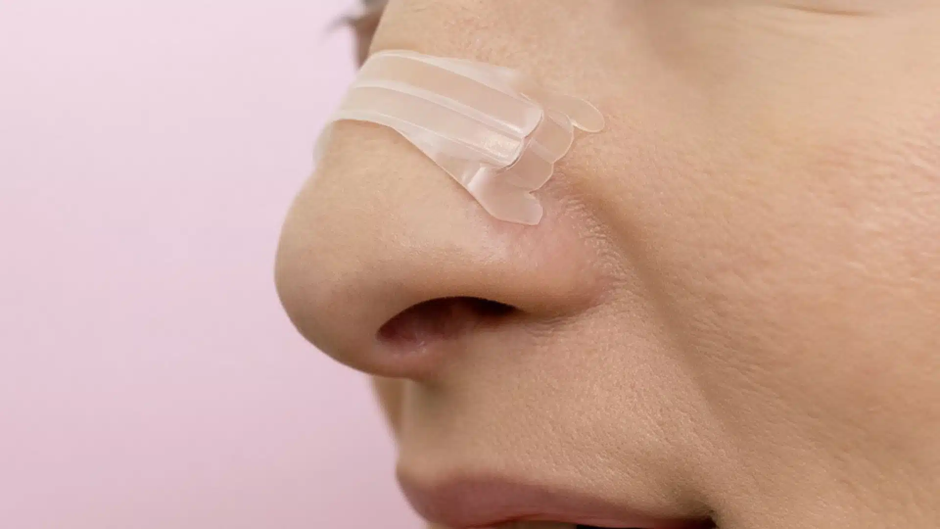 Close-up profile of a person wearing a translucent adhesive nasal strip across the bridge of the nose.